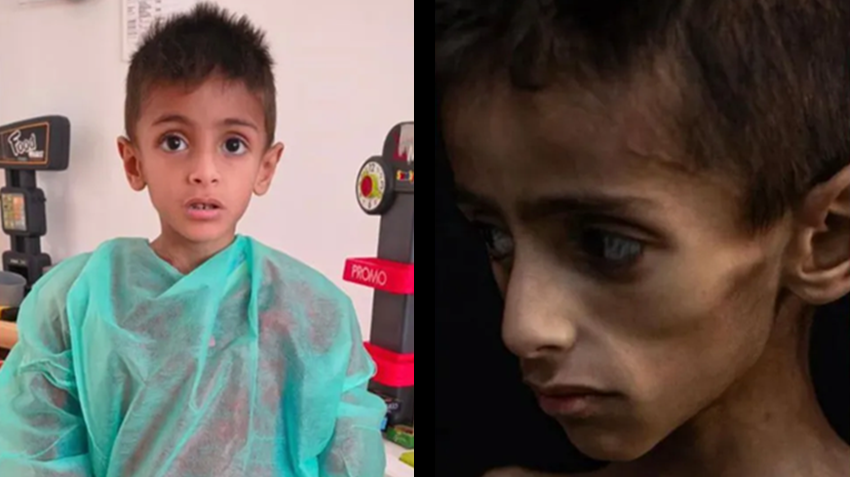 Gazan child used in viral claims of starvation evacuated to Italy, COGAT confirms